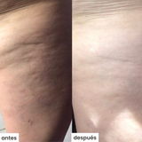 cel u - celulitis - kit c/cepillo