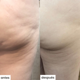 cel u - celulitis - kit c/cepillo