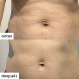 shape u c/ventosa - celulitis