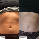 shape u c/ventosa - celulitis