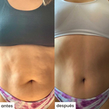 cel u - celulitis