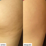 shape u c/cepillo - celulitis y queratosis pilaris